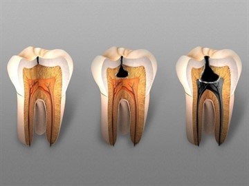Какие заболевания дают право на больничный лист от стоматолога?