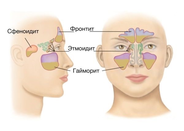 Получите бесплатную консультацию