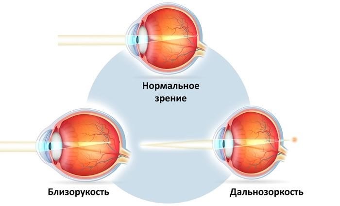 Возможно ли обмануть окулиста в военкомате?